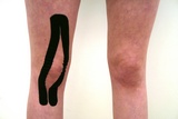 kinesiotaping: qceps stimulatie